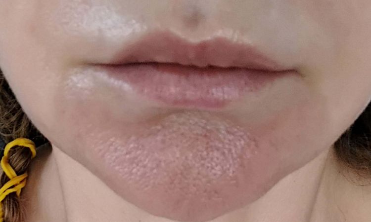 ako riešiť túto oblasť - 84202