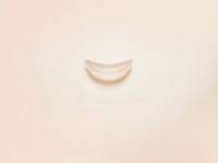 Tvárové implantáty Tvárové implantáty