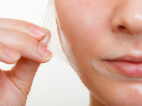 acne-peel system®