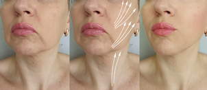 Doba rekonvalescencie