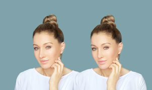 Ako zistím či som vhodný kandidát na septoplastiku?