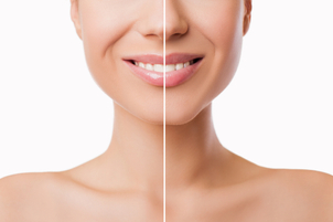 Komplikácie alebo možné vedľajšie účinky