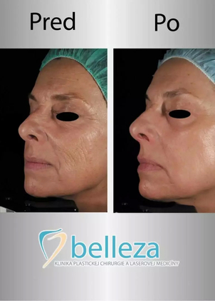 Najbežnejšie typy prísad v boji proti starnutiu