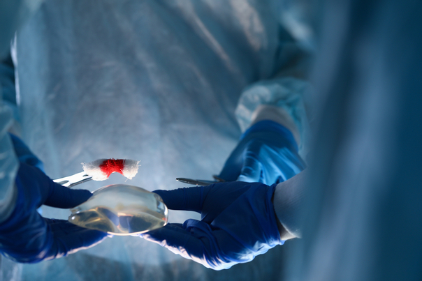 Chirurgické metódy liečby nádoru prsníka