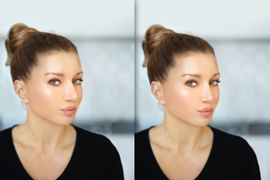 Čo je to septoplastika