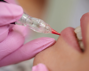 Čo je mikropigmentácia