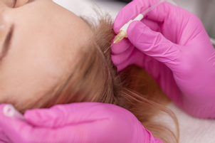 Vhodný kandidát pre mezoterapiu