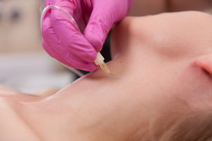 Priebeh zotavenia po karboxyterapii