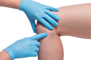 Ako sa na zákrok pripraviť?