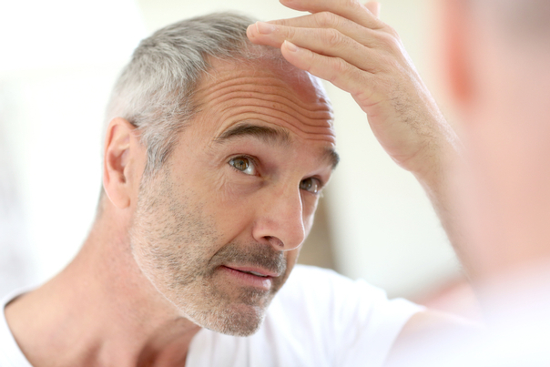 Vlasová mezoterapia je vhodná pre ľudí s nadmerným vypadávaním vlasov