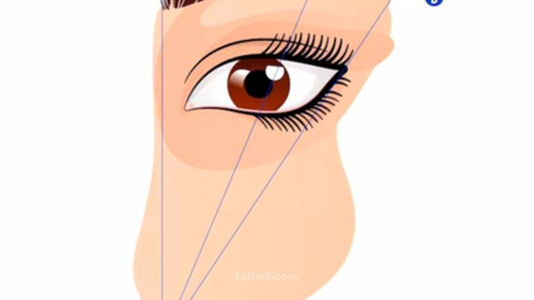 Dolná blefaroplastika