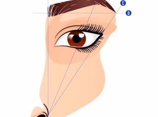 Dolná blefaroplastika