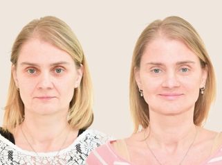 Klinika YES VISAGE v pořadu Vysněná krása 5