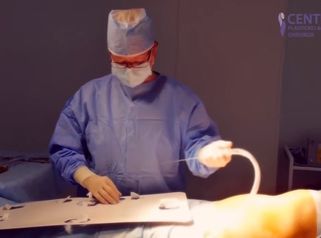 Liposukcia Water-Jet