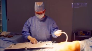 Liposukcia Water-Jet