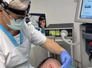 Laserové odstránenie znamienka ESSUR Clinic