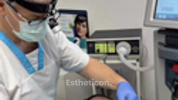 Laserové odstránenie znamienka ESSUR Clinic
