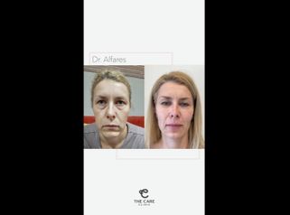 Anti Aging - The Care Clinic