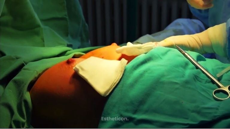 Plastická a estetická chirurgia MUDr. Eva Potocká, CSc. Poprad