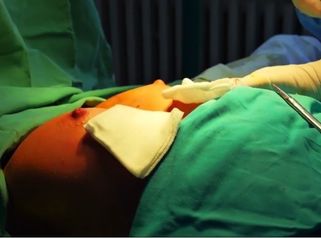Plastická a estetická chirurgia MUDr. Eva Potocká, CSc. Poprad